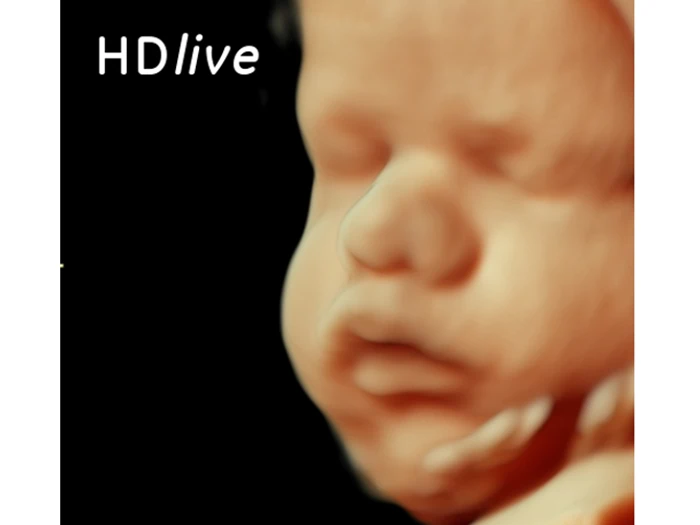 Scanningspakke med 2 x 4D/3D scanning (stor) fra Scanningsklinikken