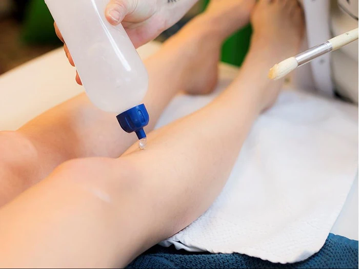 Klippekort til 5 behandlinger med terapeutisk laser på mellem område hos EPC-laser