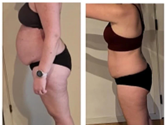 Opstramning & Vægttab For Kvinder