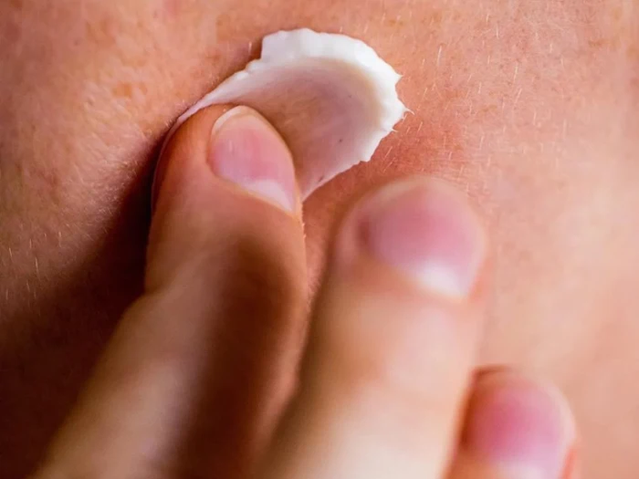 Et nærbillede af en person, der påfører en lille mængde hvid creme på sin hud med fingrene.